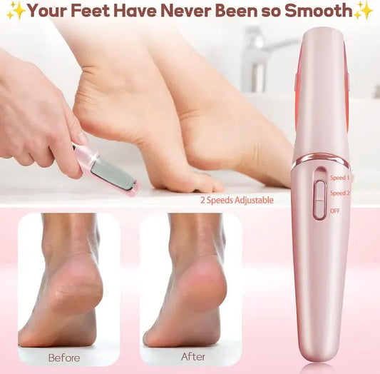 Rechargeable Foot Grinder – Smooth & Soft Feet at Home