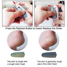 Rechargeable Pedi Callus Remover Tool for Feet – Electric Pedi Callus Remover